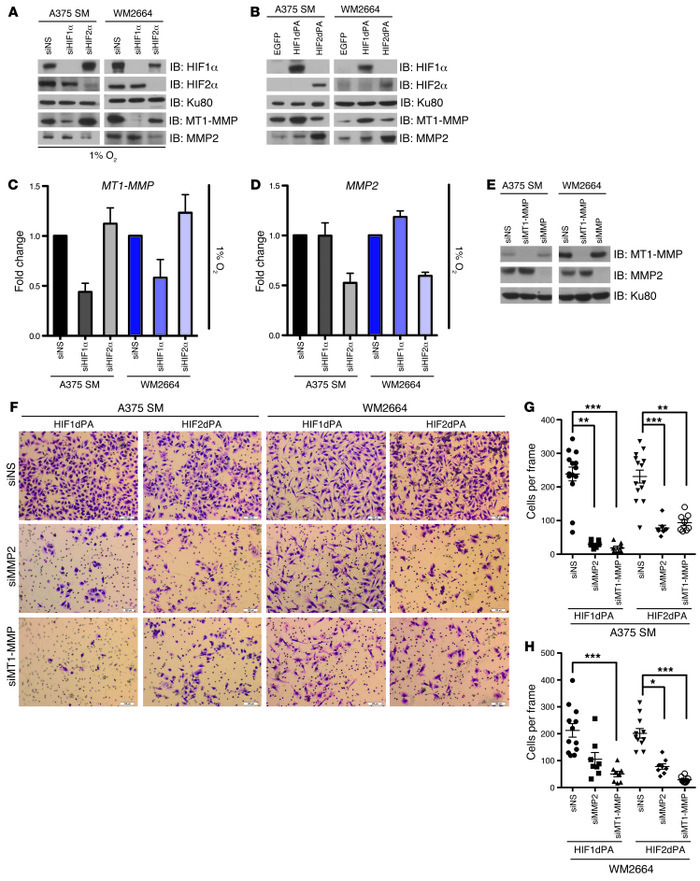 HIF1α and HIF2α regulate expression of MMPs implicated in invadopodia fo...