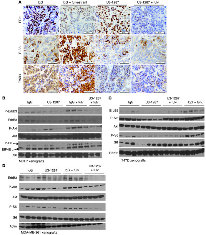 Feedback signaling through ErbB3 limits innate tumor response to endocri...