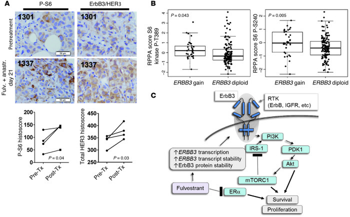 Fulvestrant-treated clinical breast tumors demonstrate ErbB3 and P-S6 up...