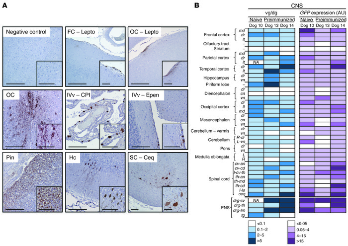 Impact of preexisting humoral immunity on CNS transduction following CSF...