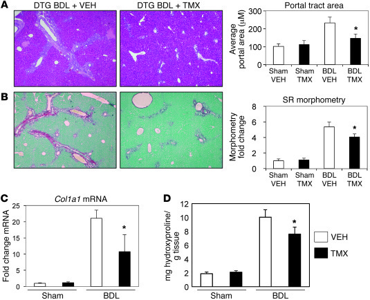 Blocking Hh signaling inhibits portal tract expansion and fibrosis in in...