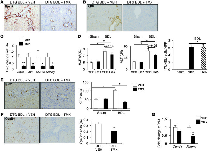 Blocking Hh signaling in MFs inhibits accumulation of liver epithelial p...