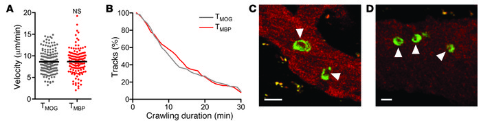 Activation status of autoreactive T cells within leptomeningeal blood ve...