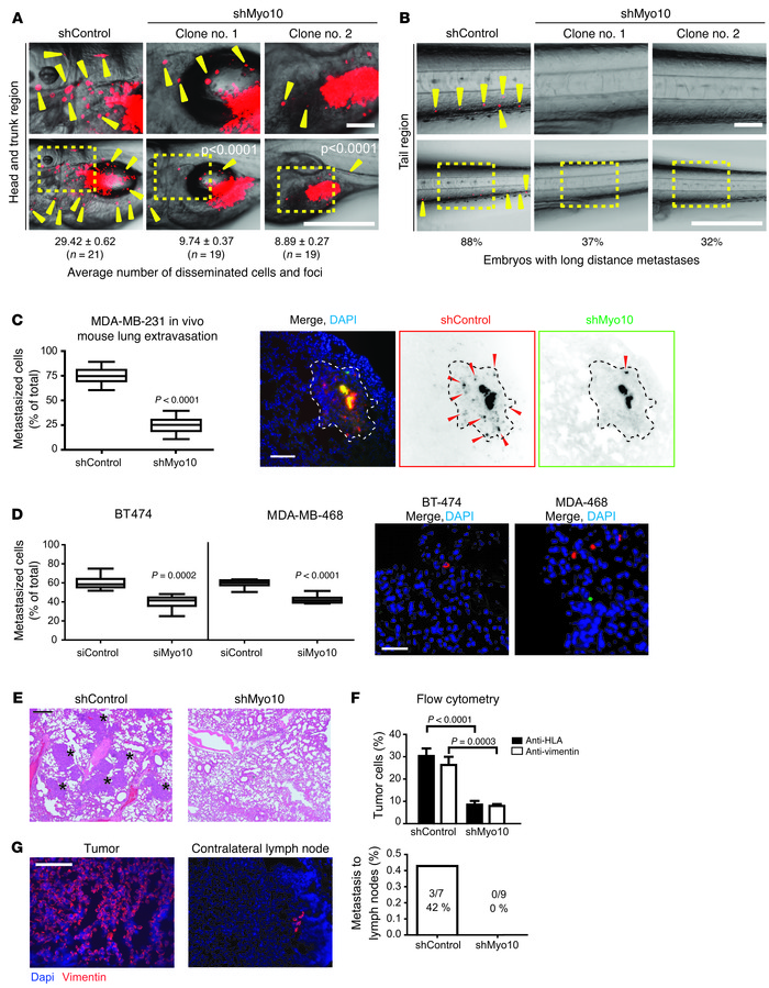 Myo10 regulates invasion and metastasis in vivo.
(A and B) Labeled shCon...