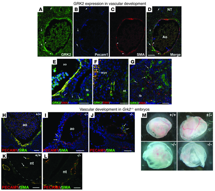 Abnormal vascular network formation and morphology in global GRK2 knocko...