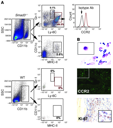 The infiltrated cells were predominantly CD11b+Gr-1+ cells, which were r...