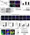 Identification of S100A9 as a native ligand for CD33.