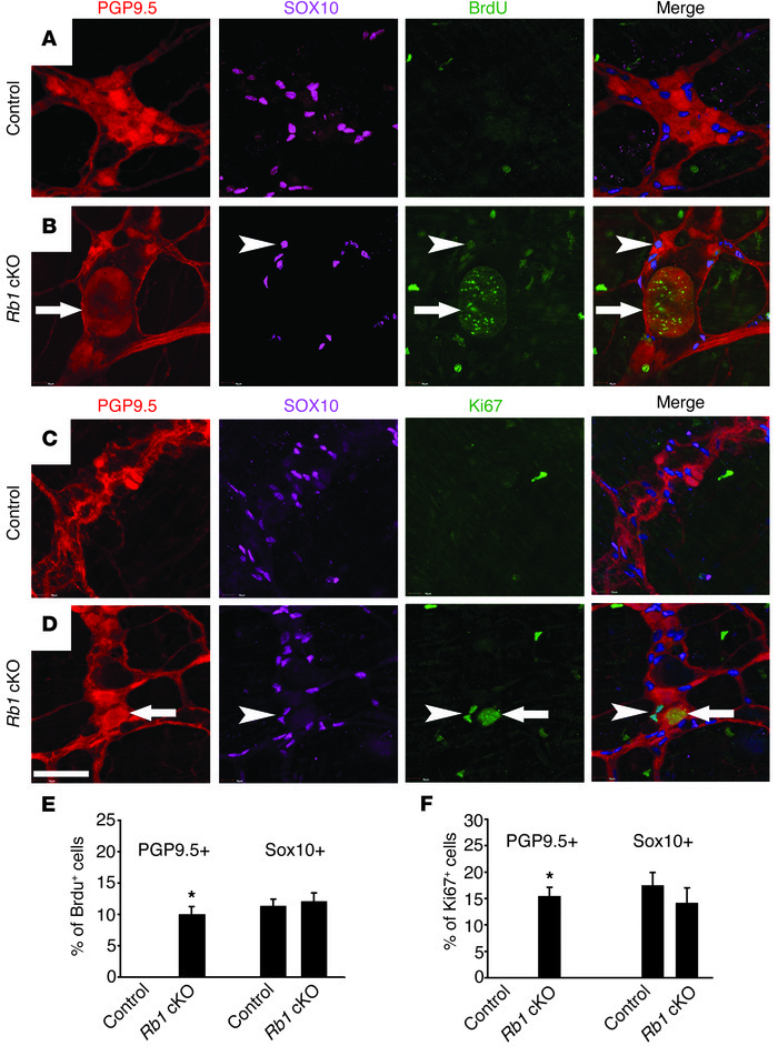 
Rb1 cKO mice have an increased number of BrdU+ and Ki67+ myenteric neur...