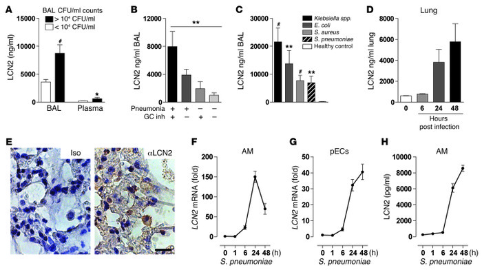 LCN2 is induced during infection in humans and mice.
(A–C) LCN2 levels w...