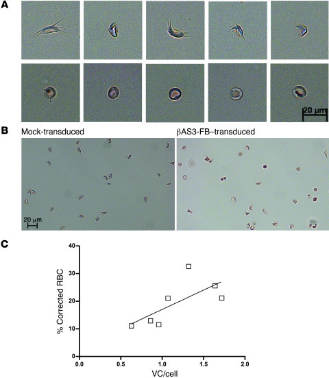 SCD phenotypic correction.
(A) Phase contrast photomicrographs of deoxyg...