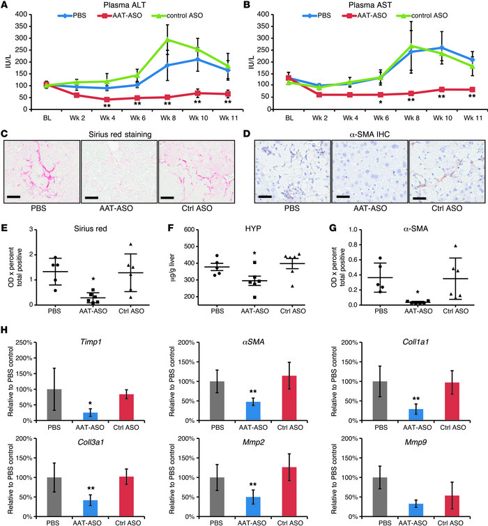 AAT-ASO treatment significantly reduced liver injury and fibrosis in PiZ...