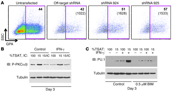 The cooperative induction of PU.1 by iron restriction and IFN-γ contribu...