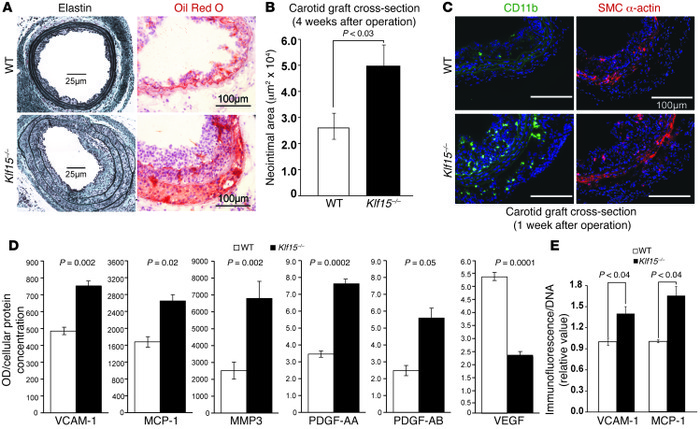 Arterial KLF15 expression reduces atherogenesis.
(A and B) Carotid arter...