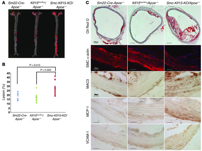 SMC-specific expression of KLF15 suppresses atherosclerosis.
(A and B) R...