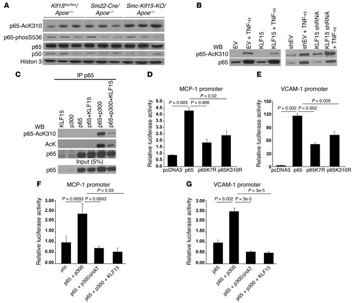KLF15 suppresses NF-κB transactivation activity in VSMCs.
(A) Western bl...
