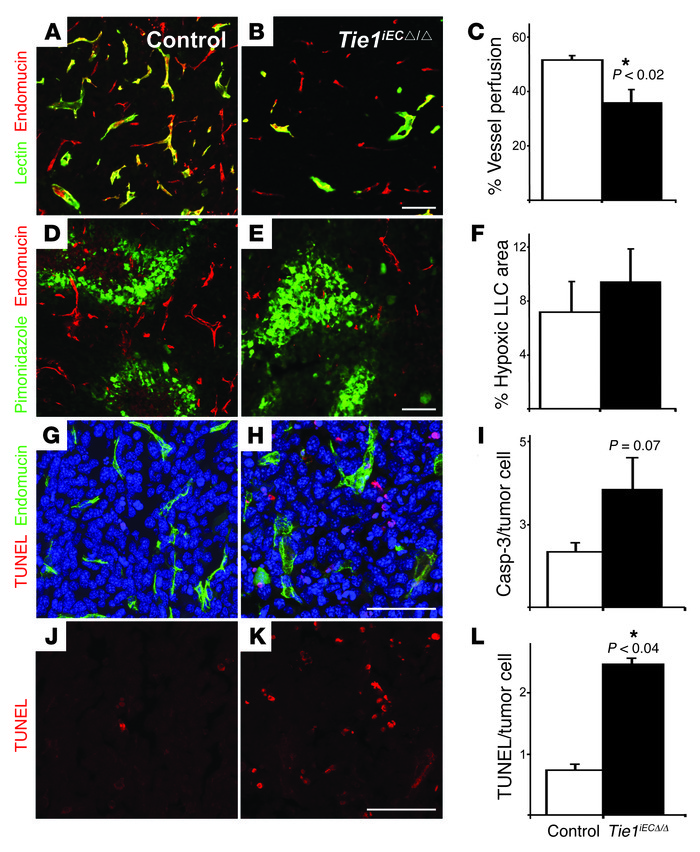 Vessel perfusion, hypoxia, and apoptosis in tumors of control and Tie1iE...