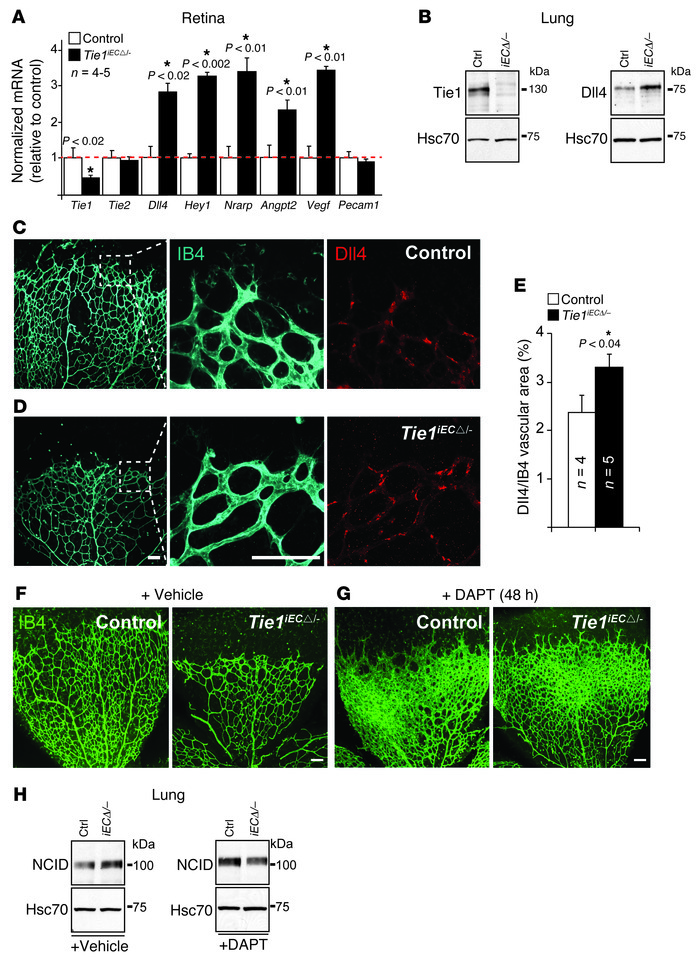 Tie1-deficient retinal phenotype involving upregulation of Dll4/Notch is...