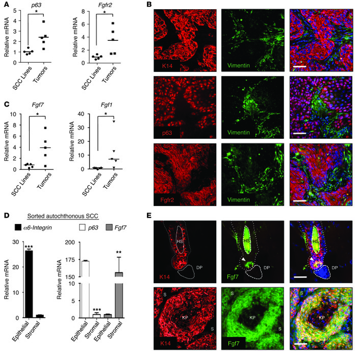 Deregulation of a paracrine FGFR2 signaling axis in autochthonous SCC.
(...