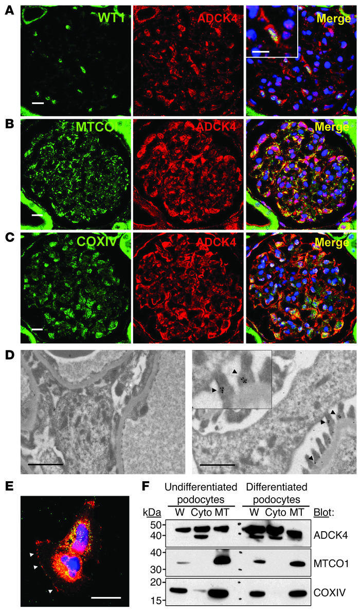 ADCK4 localizes to the mitochondria and cytoplasm of podocytes in adult ...