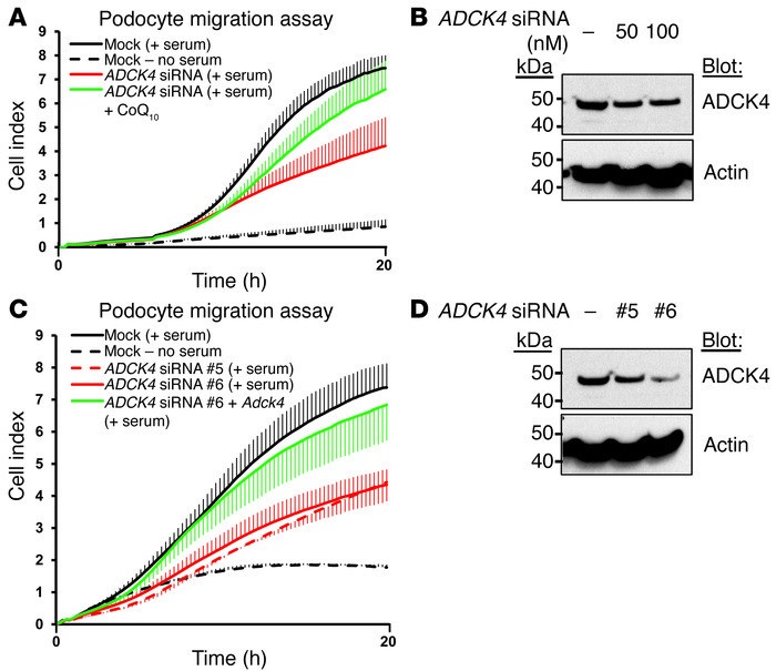 Knockdown of ADCK4 decreases the migratory phenotype of podocytes.
(A) T...