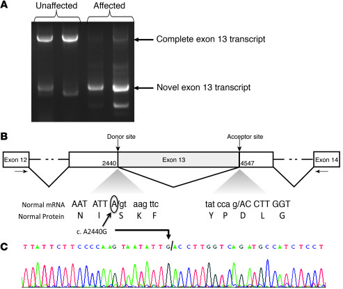 RT-PCR and diagram of novel splicing event in exon 13 of factor V.
(A) E...