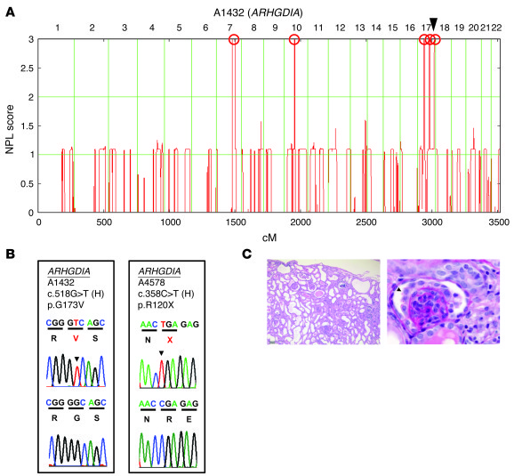 Mapping and WER reveal a novel single-gene cause of NS (ARHGDIA).
 
(A) ...