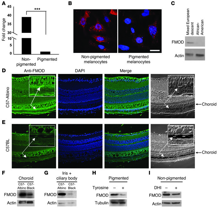 FMOD expression in pigmented and nonpigmented melanocytes.
(A) FMOD mRNA...