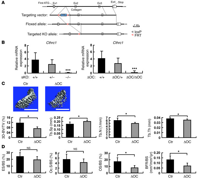 Osteoclast-specific Cthrc1 KO results in a low bone mass phenotype with ...