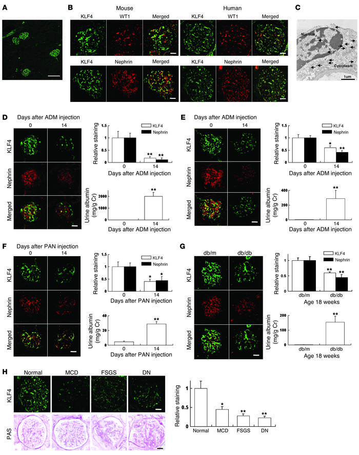 KLF4 is expressed in glomerular podocytes, and its expression is decreas...