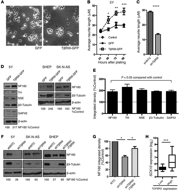 TβRIII promotes neuronal differentiation of NB cells.
Transient transduc...