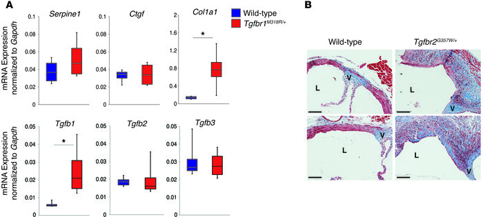 Upregulation of TGF-β1 ligand and collagen in LDS mice at 24 weeks of ag...