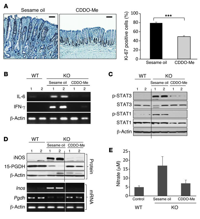 CDDO-Me treatment suppresses inflammatory mediators and increases the ex...