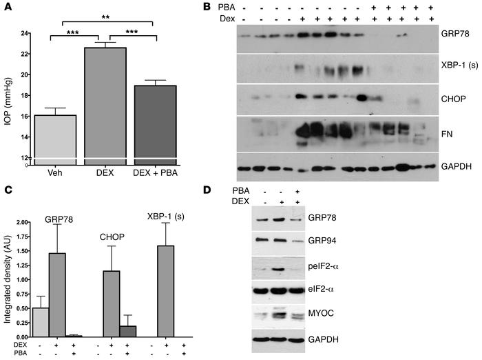 Decreasing ER stress by administration of the chemical chaperone PBA red...