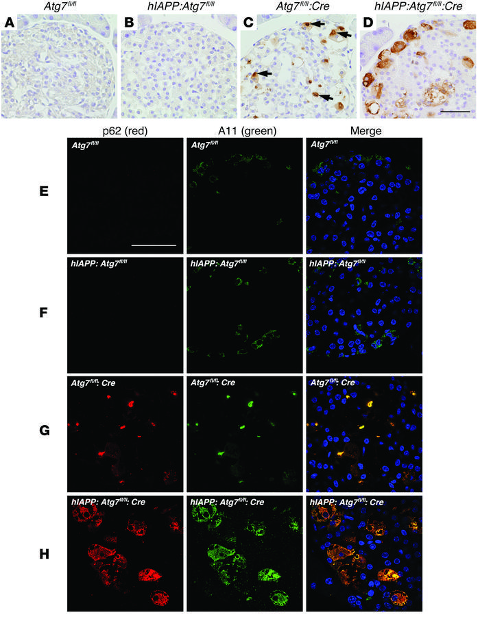 hIAPP inhibits formation of cytoplasmic inclusions immunopositive for p6...