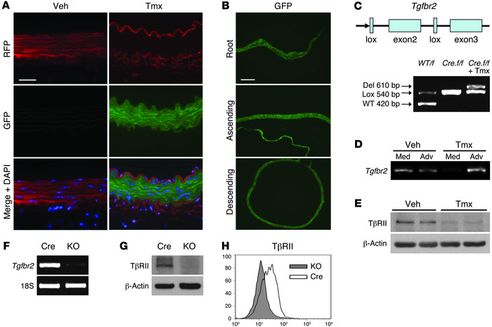 Conditional disruption of Tgfbr2 in smooth muscle of postnatal mice.
 
(...