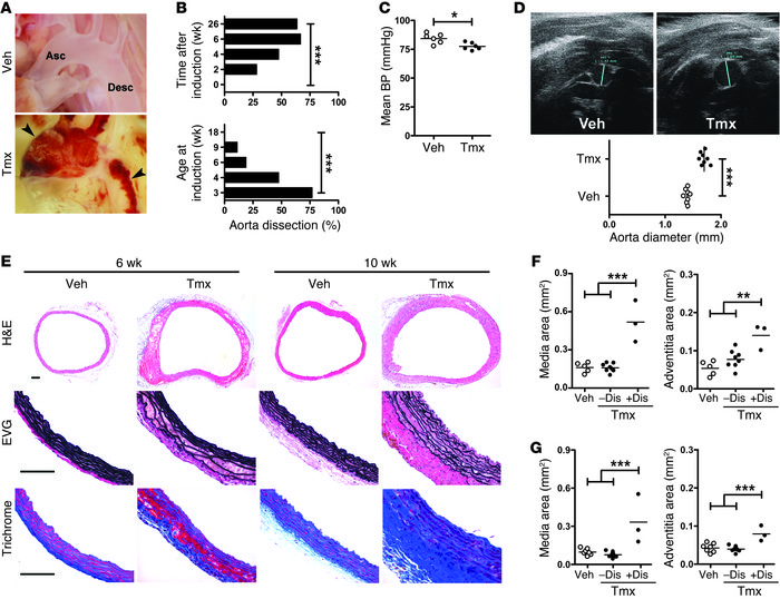 
Tgfbr2 disruption in smooth muscle results in aortic thickening, dilata...