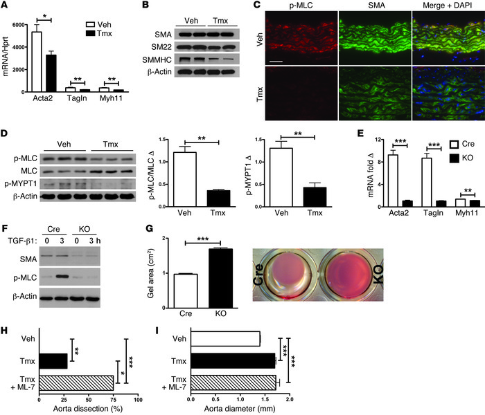 Loss of TGF-β signaling impairs the contractile apparatus of vascular sm...