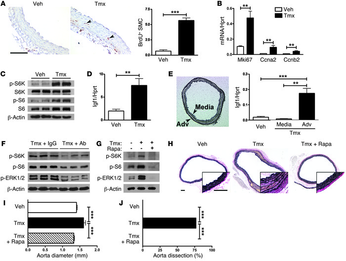 Loss of TGF-β signaling induces vascular cell proliferative responses.
(...
