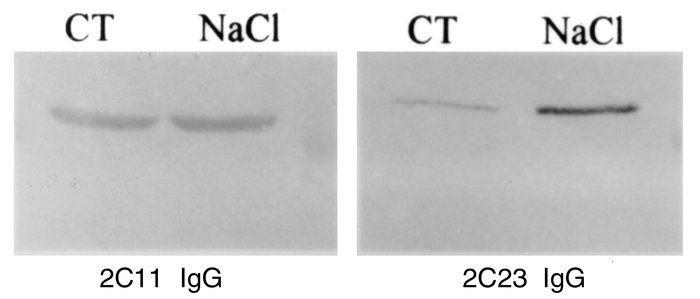 Immunoelectrophoresis of microsomal fractions isolated from the kidneys ...