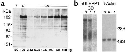 (a) Western blot of proteins extracted from glomeruli isolated from Ptpr...