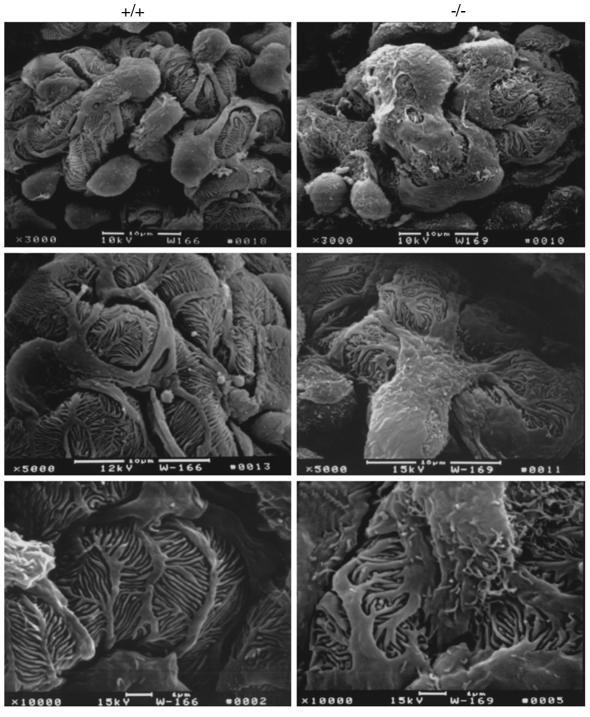 Scanning electron micrographs of glomeruli made at different magnificati...