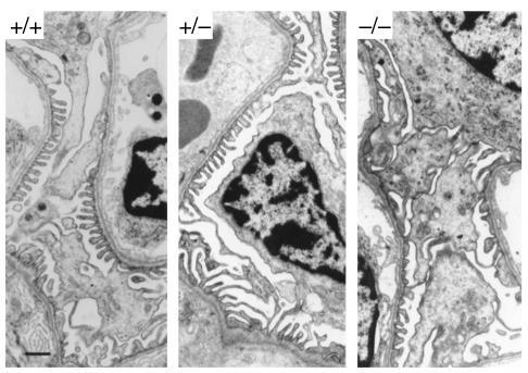 Transmission electron micrographs showing glomerular capillary loops fro...