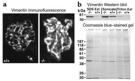 (a) Immunofluorescence photomicrographs developed with anti-vimentin Ab’...