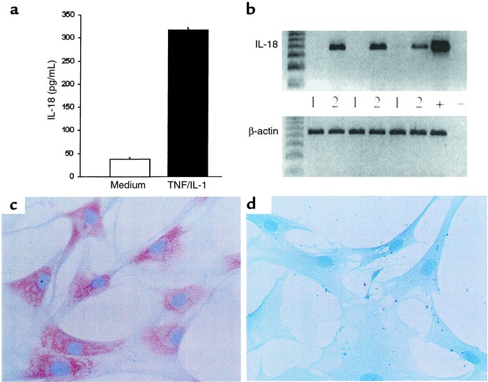 (a) IL-18 from synovial membrane cultures representative of 4 positive c...