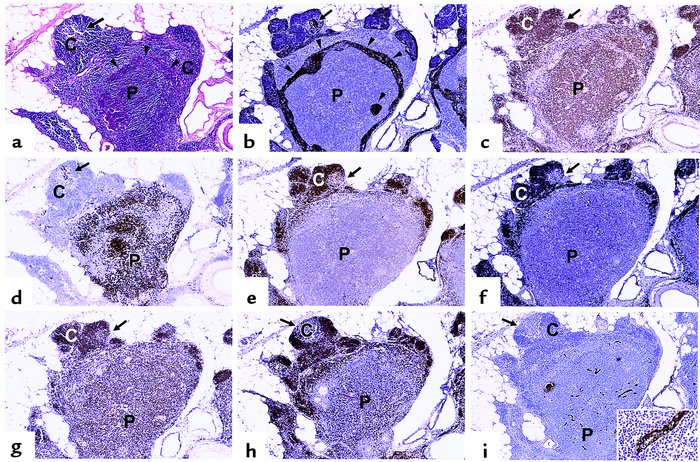 Phenotypes of cells present in the thymic PVS. Thymus from a 42-year-old...