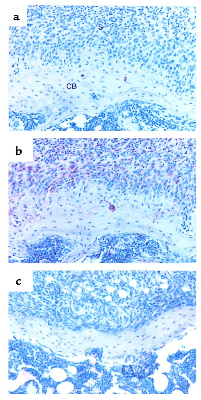 Effects of IL-4 on OPGL expression in the synovium. (a and b) Arthritic ...