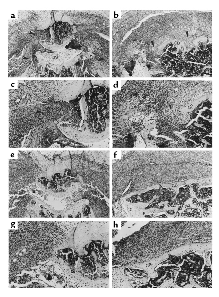 Effects of Ad5E1mIL-4 on bone erosion in CIA. (a–d) Arthritic knee joint...