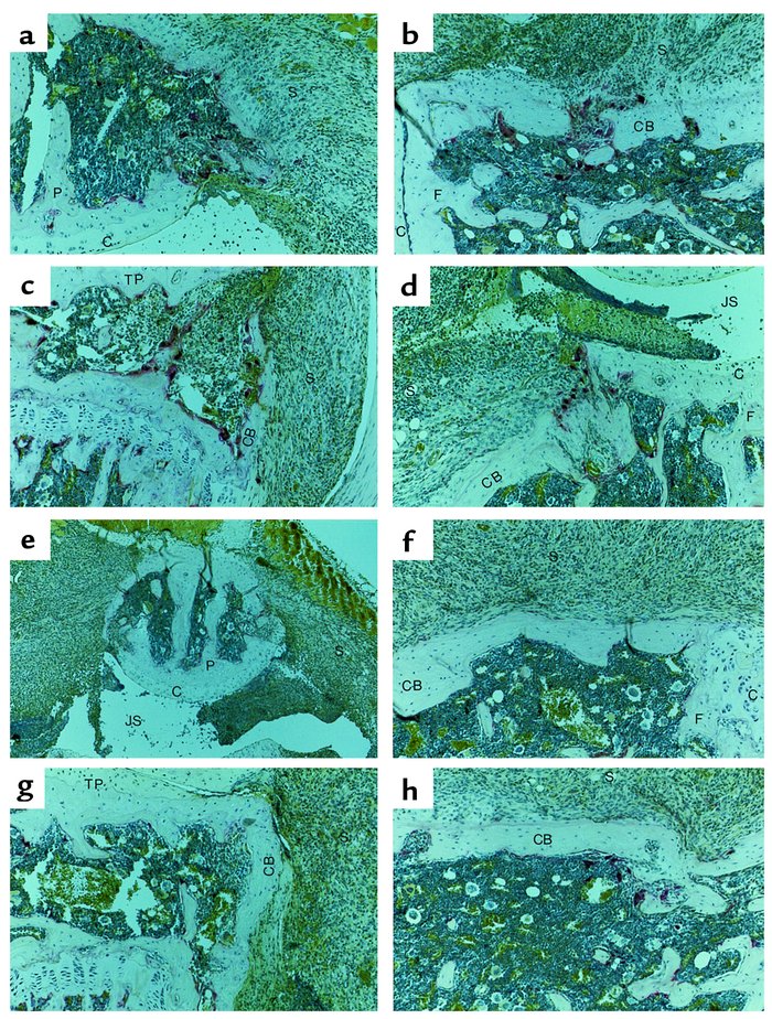 Effects of Ad5E1mIL-4 on osteoclast-like cells. (a–d) Arthritic knee joi...