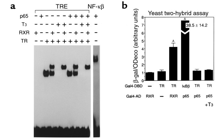 Lack of association of TR with NF-κB p65 subunit in the presence or abse...