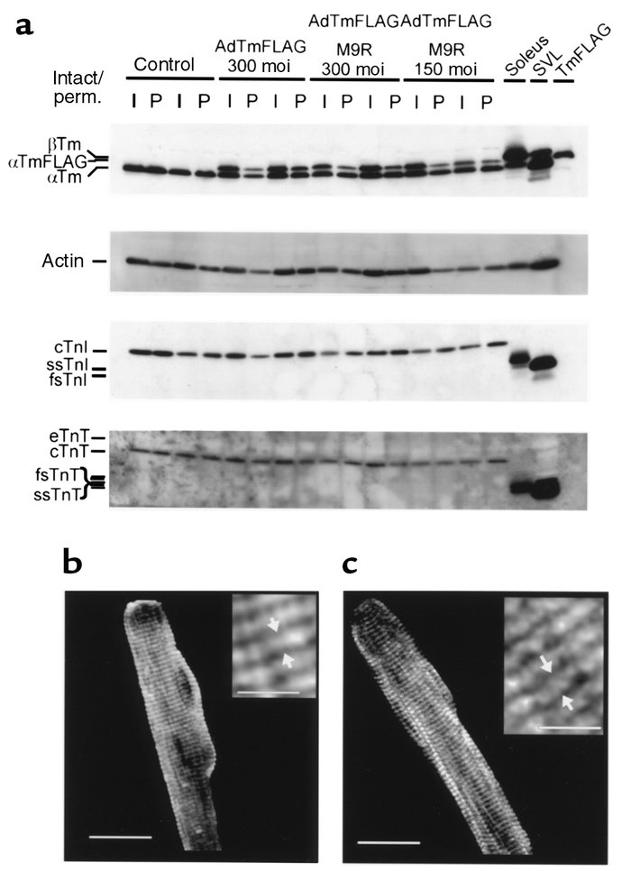 (a) Expression of thin filament proteins in adult myocytes expressing no...
